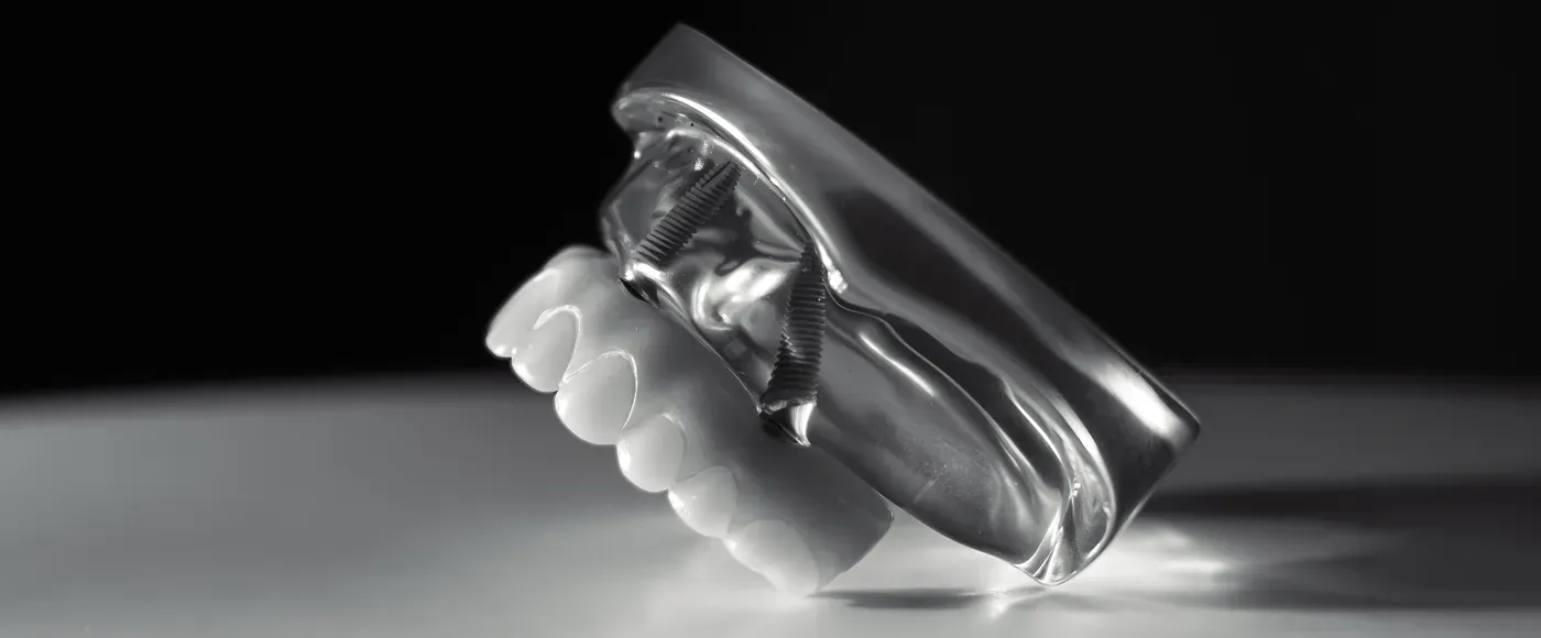 Modèle 3D d'un dentier
